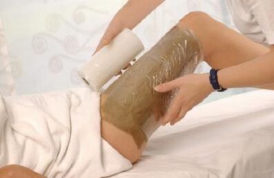 Acetic wraps have been shown to be effective for varicose veins in the legs