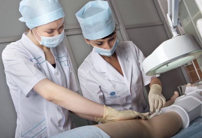 Performing surgery for leg varicose veins